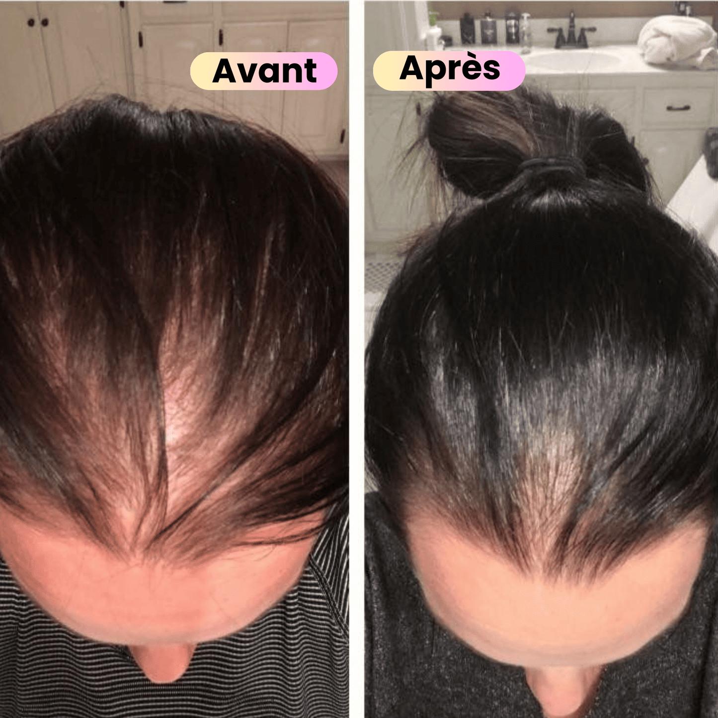 Sérafinaé™ Révolution Capillaire 3-en-1